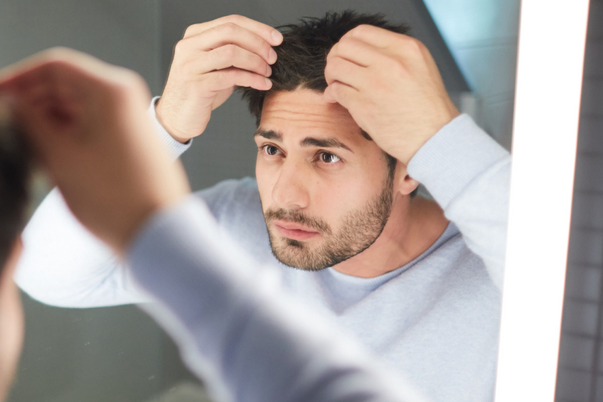 men-hairloss